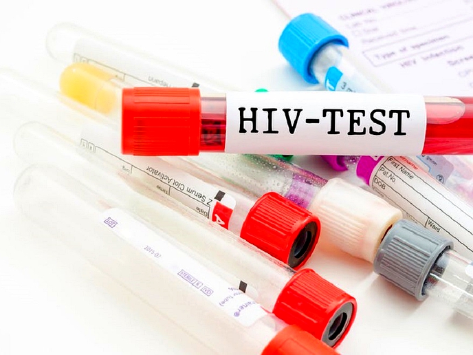 Care and support body targets HIV prevention