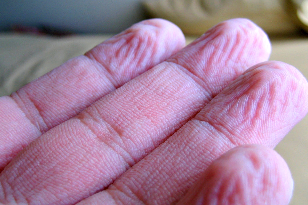 Why does our skin wrinkle in water? Why does our skin wrinkle in water?